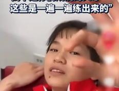 海德体育官方入口-勇士在比赛中受伤退赛，恒大主帅表示担忧！